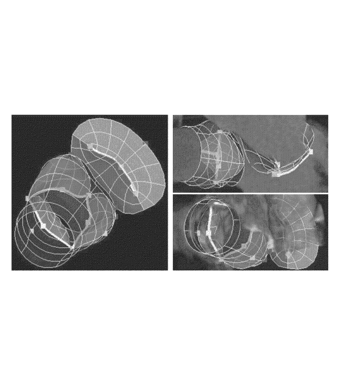 US8771189B2 — Valve assessment from medical diagnostic imaging data